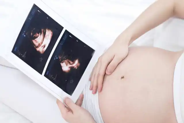 Nhìn Cổ Tay Biết Có Thai: 7 Thực Hư Và Khoa Học Đằng Sau